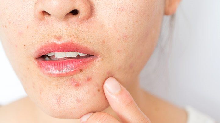 Breakouts